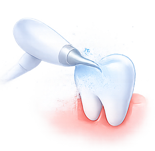 Airflow – pískování